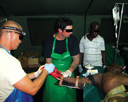 CPT Haynes* and SSG Coverdale* examine the severely injured right hand of a UDPF soldier.